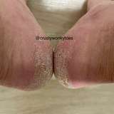 crustywonkytoes